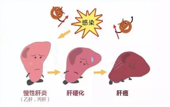 肝脏不好可以吃灵芝孢子粉吗?灵芝孢子粉对肝脏有什么帮助？